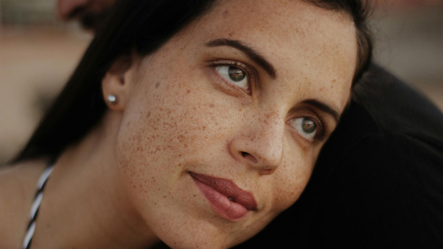 Как убрать пигментные пятна на лице? Как убрать пигментные пятна на лице?